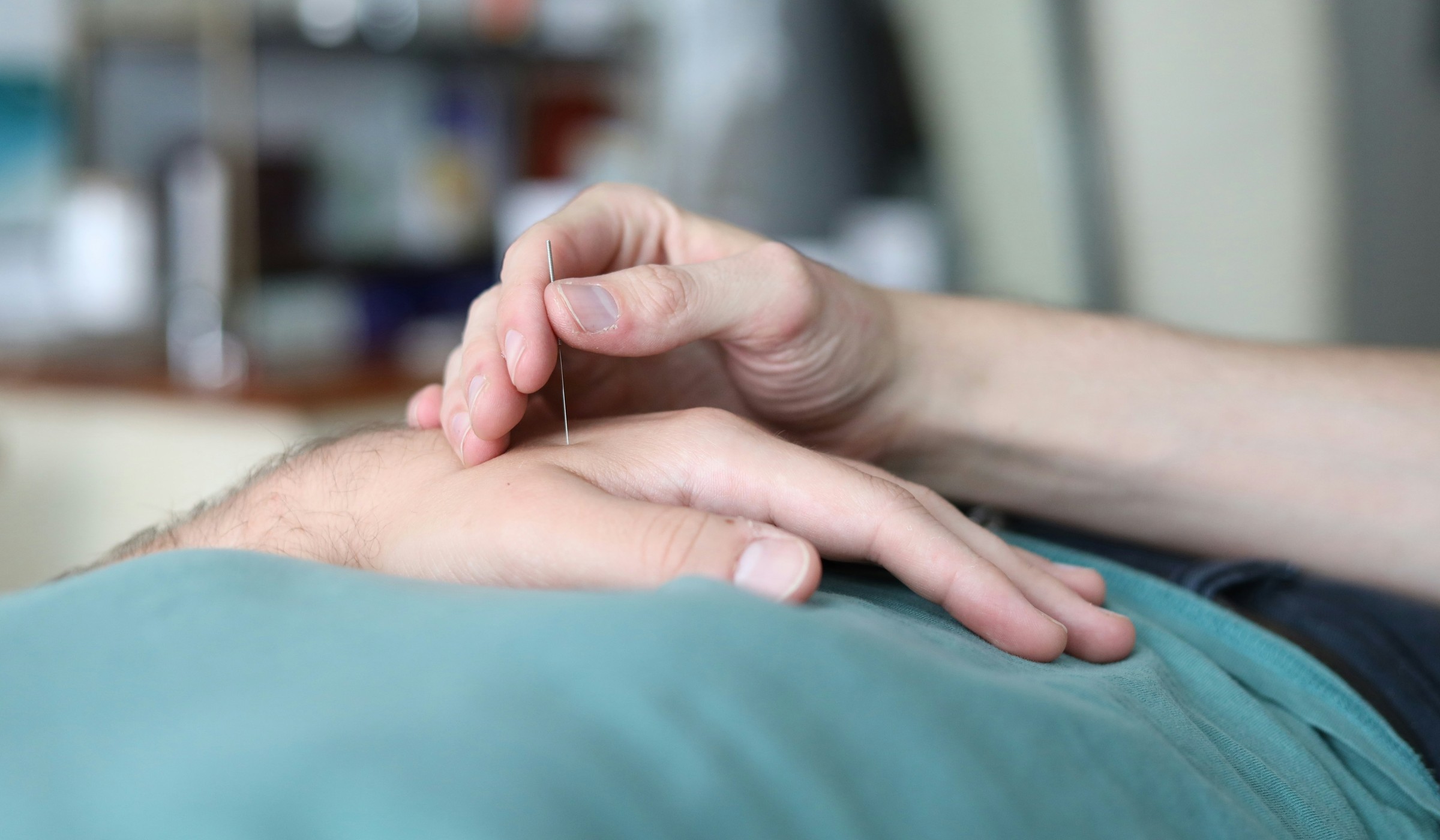Acupuncture treatment using fine needles
